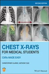 Book cover of Chest X-Rays for Medical Students (2nd ed.) by Christopher Clarke