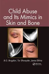 Book cover of Child Abuse and its Mimics in Skin and Bone by Unknown