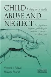 Book cover of Child Abuse & Neglect by Vincent Palusci