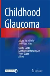 Book cover of Childhood Glaucoma by Shikha Gupta