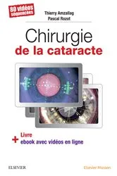 Book cover of Chirurgie de la cataracte by Thierry Amzallag