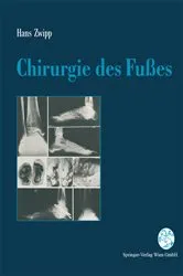 Book cover of Chirurgie des Fußes by Hans Zwipp