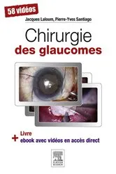 Book cover of Chirurgie des glaucomes by Jacques LALOUM