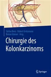 Book cover of Chirurgie des Kolonkarzinoms by Stefan Benz