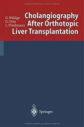 Book cover of Cholangiography After Orthotopic Liver Transplantation by Gerd Nöldge