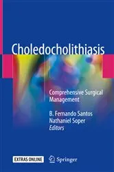 Book cover of Choledocholithiasis by B. Fernando Santos