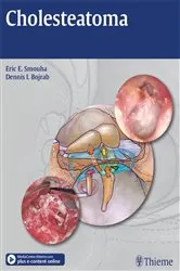 Book cover of Cholesteatoma by Eric E. Smouha