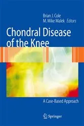 Book cover of Chondral Disease of the Knee by Brian J. Cole
