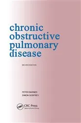 Book cover of Chronic Obstructive Pulmonary Disease: pocketbook by Peter Barnes