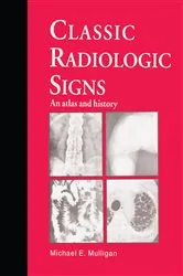 Book cover of Classic Radiologic Signs by M.E. Mulligan