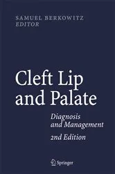 Book cover of Cleft Lip and Palate (2nd ed.) by Unknown