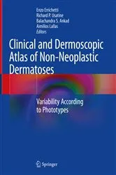 Book cover of Clinical and Dermoscopic Atlas of Non-Neoplastic Dermatoses by Enzo Errichetti