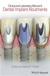 Book cover of Clinical and Laboratory Manual of Dental Implant Abutments by Hamid R. Shafie