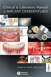 Book cover of Clinical and Laboratory Manual of Implant Overdentures by Hamid R. Shafie