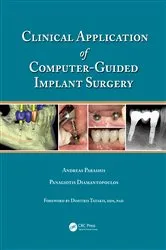 Book cover of Clinical Application of Computer-Guided Implant Surgery by Andreas Parashis