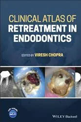 Book cover of Clinical Atlas of Retreatment in Endodontics by Viresh Chopra