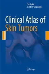 Book cover of Clinical Atlas of Skin Tumors by Can Baykal