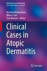 Book cover of Clinical Cases in Atopic Dermatitis by Nicholas Brownstone