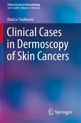 Book cover of Clinical Cases in Dermoscopy of Skin Cancers by Danica Tiodorovic