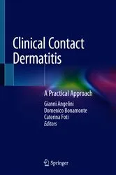 Book cover of Clinical Contact Dermatitis by Gianni Angelini