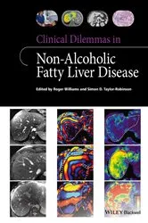Book cover of Clinical Dilemmas in Non-Alcoholic Fatty Liver Disease by Roger Williams