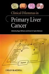 Book cover of Clinical Dilemmas in Primary Liver Cancer by Roger Williams