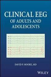 Book cover of Clinical EEG of Adults and Adolescents by David P. Moore
