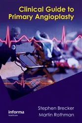 Book cover of Clinical Guide to Primary Angioplasty by Stephen Brecker