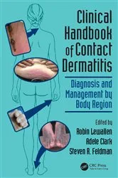 Book cover of Clinical Handbook of Contact Dermatitis by Unknown