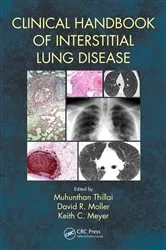 Book cover of Clinical Handbook of Interstitial Lung Disease by Keith C. Meyer
