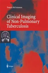 Book cover of Clinical Imaging in Non-Pulmonary Tuberculosis by Francis E. McGuinness