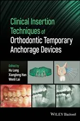 Book cover of Clinical Insertion Techniques of Orthodontic Temporary Anchorage Devices by Hu Long