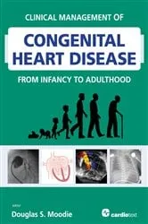 Book cover of Clinical Management of Congenital Heart Disease from Infancy to Adulthood by Douglas Moodie
