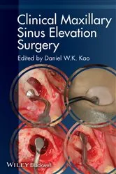 Book cover of Clinical Maxillary Sinus Elevation Surgery by Daniel W. K. Kao