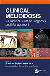 Book cover of Clinical Melioidosis by Prasanta Raghab Mohapatra