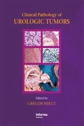 Book cover of Clinical Pathology of Urological Tumours by Gregor Mikuz