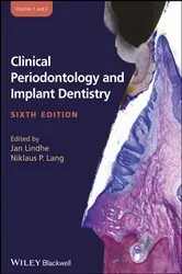 Book cover of Clinical Periodontology and Implant Dentistry, 2 Volume Set (6th ed.) by Niklaus P. Lang