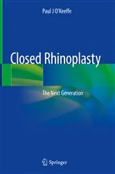 Book cover of Closed Rhinoplasty by Paul J O'Keeffe