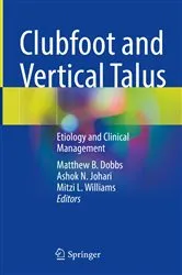 Book cover of Clubfoot and Vertical Talus by Matthew B. Dobbs
