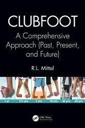 Book cover of Clubfoot by R. L. Mittal