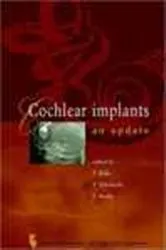 Book cover of Cochlear Implants - An Update by T. Kubo
