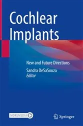 Book cover of Cochlear Implants by Sandra DeSaSouza
