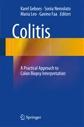 Book cover of Colitis by Michael P. Kelly