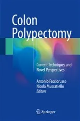 Book cover of Colon Polypectomy by Antonio Facciorusso