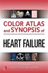 Book cover of Color Atlas and Synopsis of Heart Failure by Ragavendra Baliga