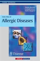 Book cover of Color Atlas of Allergic Diseases by Martin Röcken