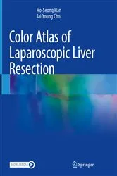 Book cover of Color Atlas of Laparoscopic Liver Resection by Ho-Seong Han