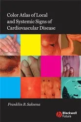 Book cover of Color Atlas of Local and Systemic Manifestations of Cardiovascular Disease by Franklin B. Saksena