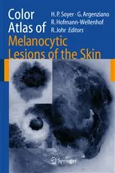 Book cover of Color Atlas of Melanocytic Lesions of the Skin by H. Peter Soyer