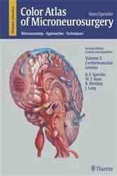 Book cover of Color Atlas of Microneurosurgery: Volume 2 - Cerebrovascular Lesions (2nd ed.) by Wolfgang T. Koos